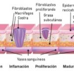 Figura 2. Proceso de cicatrización